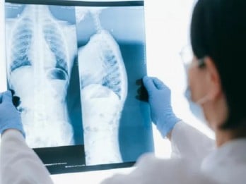Sejumlah Dokter Radiologi Belum Terima STR meski Telah Ujian Kompetensi