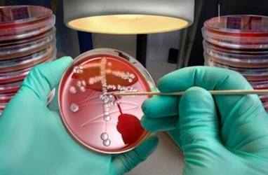 Kenali Apa Itu'Superbug', Bakteri dan Jamur yang Kebal Antibiotik