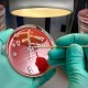 Kenali Apa Itu'Superbug', Bakteri dan Jamur yang Kebal Antibiotik