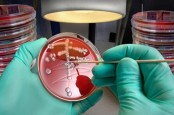 Kenali Apa Itu'Superbug', Bakteri dan Jamur yang Kebal Antibiotik