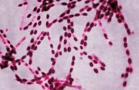 Gejala Infeksi ‘Superbug’ yang Mengancam Jiwa