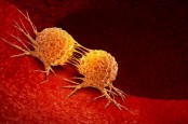 Apa Itu Karsinogenik, Kandungan Berbahaya dalam Obat dan Kosmetik, Bisa Sebabkan Kanker