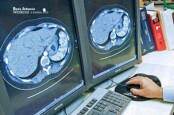 Politisi Partai Demokrat Andi Arief Mengaku Jalani Progam "Cuci Otak" Dokter Terawan