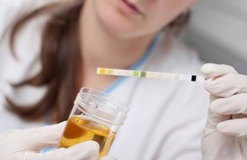 Urine Berbusa Tanda Bocor Ginjal, Ini Cara Pemeriksaannya