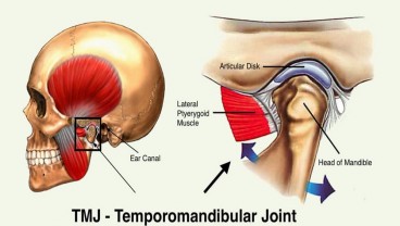 Apa Itu Temporomandibular Joint, Penyebab dan Cara Menanganinya