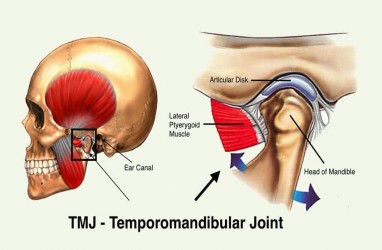 Apa Itu Temporomandibular Joint, Penyebab dan Cara Menanganinya