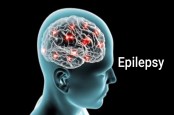 Gejala Awal Epilepsi, Jangan Diabaikan