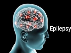 Gejala Awal Epilepsi, Jangan Diabaikan