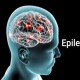 Gejala Awal Epilepsi, Jangan Diabaikan