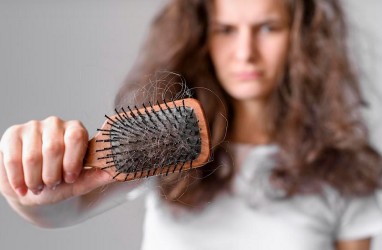 Gejala dan Penyebab Alopecia Areata yang Bikin Rambut Rontok Parah