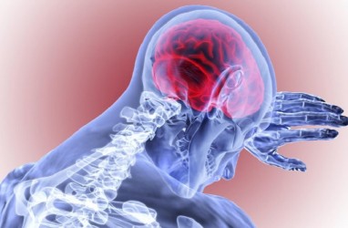 Gejala dan Penyebab Pendarahan Otak, Seperti yang Dialami Indra Bekti