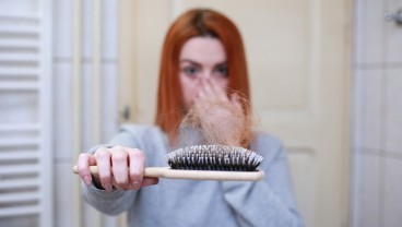 Penyebab dan Cara Mengatasi Rambut Rontok dengan Bahan Alami