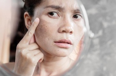 Ini 8 Cara Menghilangkan Flek Hitam di Wajah dengan Bahan Alami