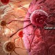 Penyebab Tidak Semua Sel Kanker Mempan Dikemoterapi