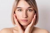 Manfaat Hyalucomplex-10 dan Panthenol untuk Menghidrasi Kulit