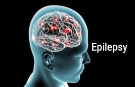Paradigma baru Penanganan Komprehensif Kasus Epilepsi