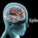 Paradigma baru Penanganan Komprehensif Kasus Epilepsi