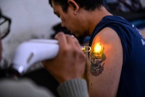 Komunitas Hijrah Care Gelar Program Hapus Tato Gratis di Bandung Selama Bulan Ramadan