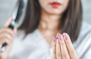 Stres Sebabkan Rambut Rontok, Ini Cara Mengobatinya