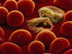 Waspada! Malaria Dapat Menyebabkan Gagal Ginjal Akut