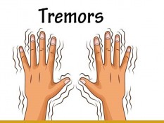 Tangan Anda Sering Tremor? Bisa Jadi Ini Penyebabnya