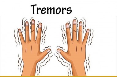 Tangan Anda Sering Tremor? Bisa Jadi Ini Penyebabnya