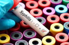 Ini Gejala dan Cara Mencegah Penyakit Sifilis