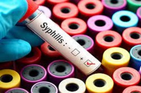 Ini Gejala dan Cara Mencegah Penyakit Sifilis