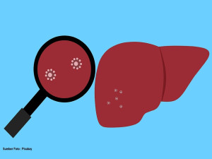 Waspada, Cara Berjalan Bisa jadi Tanda Sakit Liver