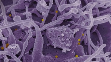 Ada Virus Mematikan Baru yang Menyebar ke Seluruh Eropa