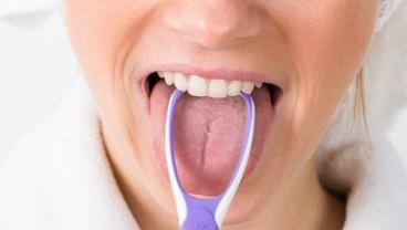 Viral Lidah Seorang Pria jadi Hijau dan Berbulu Gara-gara Merokok, Ini Fakta Hairy Tongue