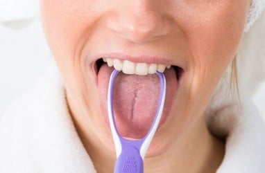 Viral Lidah Seorang Pria jadi Hijau dan Berbulu Gara-gara Merokok, Ini Fakta Hairy Tongue