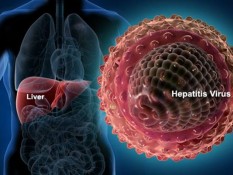 Tipe-Tipe Hepatitis dan Gejalanya