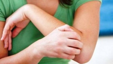 Waspada! Alergi Makanan Bisa Picu Beragam Penyakit Berikut Ini