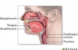 Gejala dan Penyebab Angina Ludwig yang Lagi Viral di Medsos