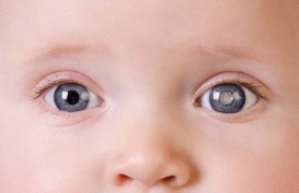 10 Masalah Kesehatan Mata yang Biasa Dialami Anak-anak