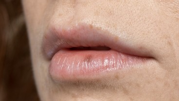 Arti Kedutan Bibir Atas dan Bawah dalam Primbon serta Medis
