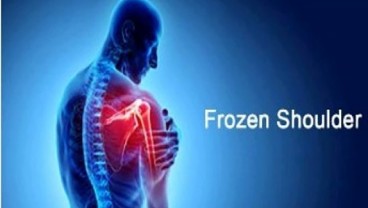 Hal yang Harus Dilakukan dan Dihindari Jika Anda Mengalami Frozen Shoulder