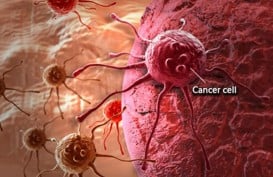 Pasien Kanker di Bawah Usia 50 Tahun Meningkat dalam 30 Tahun Terakhir