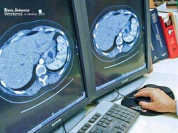 Bocah Perempuan 5 Tahun Meninggal Terserang Bakteri Sebabkan Mati Otak, Gejala Mirip Flu