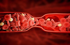 Konsumsi Obat Pereda Nyeri dan Kontrasepsi Hormonal Bersamaan  Picu Pembekuan Darah