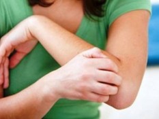 Ini Bedanya Alergi Susu Sapi dengan Laktosa Intoleran