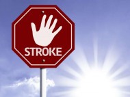 Waspada, Polusi Udara Bisa Meningkatkan Risiko Stroke
