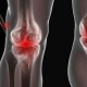Simak 2 Cara Alami Redakan Nyeri Sendiri Akibat Arthritis