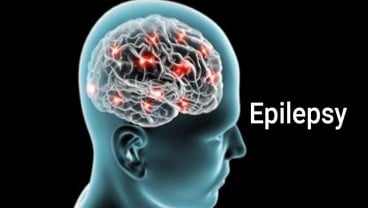 Gejala dan Penyebab Epilepsi pada Anak