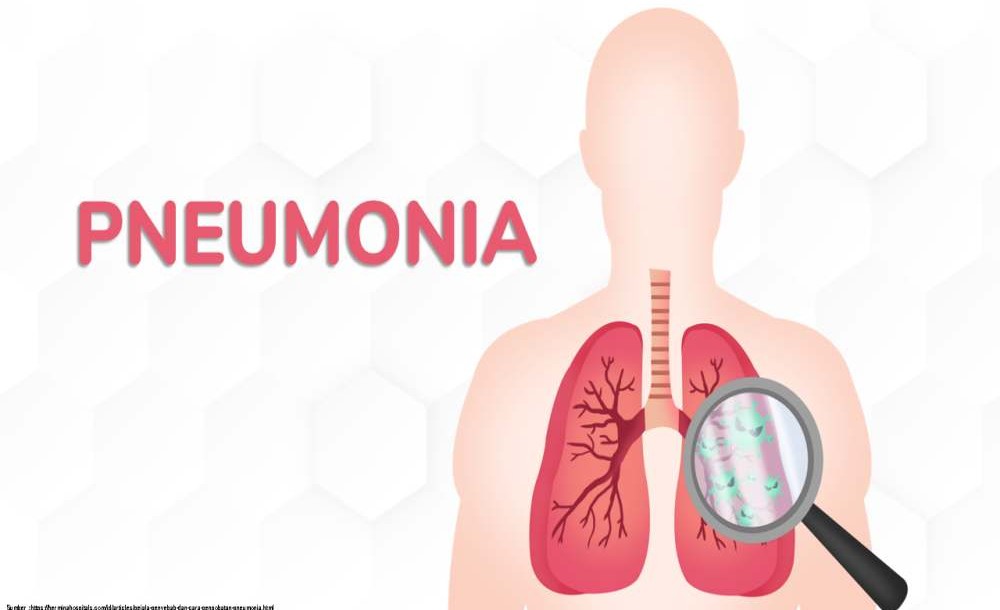 Pneumonia Misterius Merebak, Ancaman Baru Dunia?