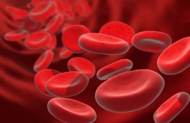 Gejala dan Penyebab Anemia Aplastik, Penyakit Kelainan Darah yang Langka