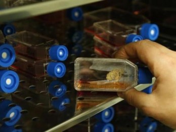 Prodia (PRDA) Gelontorkan Rp100 Miliar Bangun Fasilitas Stem Cell