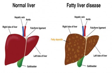 Tips Menjaga Liver Tetap Sehat di Tahun Baru 2024