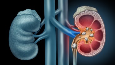 Tanpa 8 Organ Ini Manusia Masih Bisa Hidup, Termasuk Ginjal dan Limpa